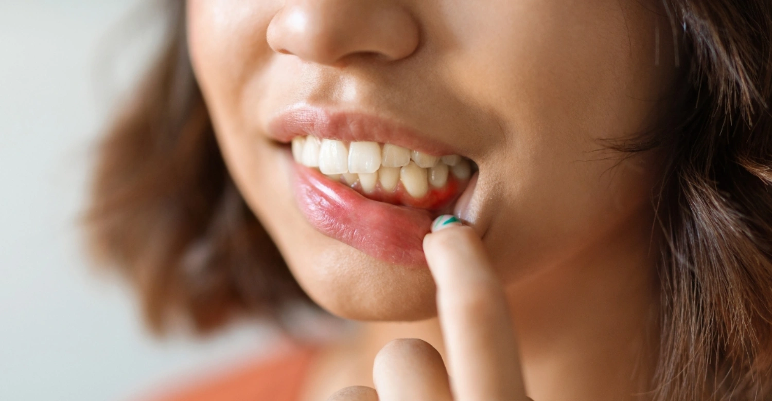 How to treat periodontal disease